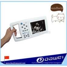 portable ultrasound scan device & handheld ultrasound scanner